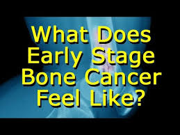 What does the skeleton protect the organs from? What Does Early Stage Bone Cancer Feel Like Youtube