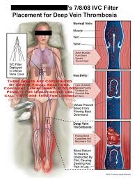 Medical Exhibits Demonstrative Aids Illustrations And Models