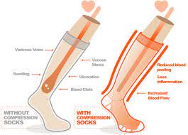 How Long Can You Wear Compression Socks More