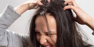 Hair dye kills live lice but do not kill nits (lice eggs). 8 Effectively Easy Ways To Get Rid Of Lice