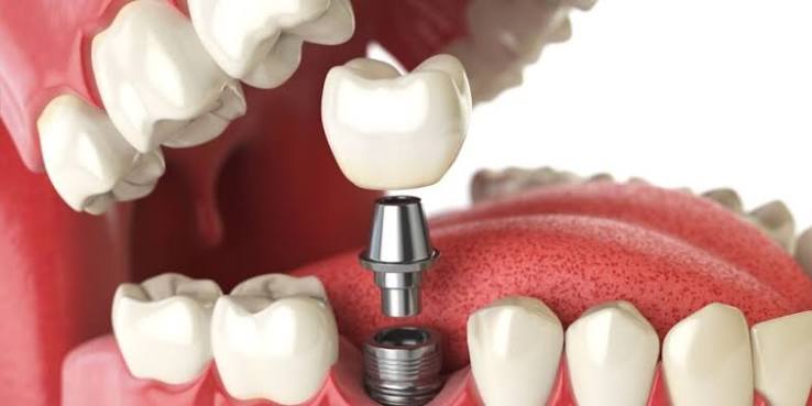 EMG dentist Lindenwold