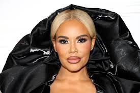 Emmy Award-Winning Actor James Coco, 56, Dies of Heart Attack