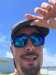 Lip Filler Reactions: My Swollen Face Experience