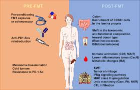 Image result for Fecal Transfer