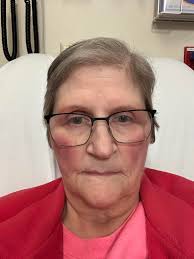 Emergency Room Visit Due to High Diabetes