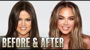 Plastic surgery is a modern technology that is constantly and very actively developing. Khloe Kardashian Plastic Surgery 2020 Youtube