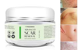 Diy beauty add vitamin e to your homemade beauty formulations. Vitamin E And Scar Prevention Or Removal