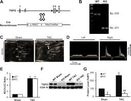 Pressure points pdf to give an internal martial artist global insight into the energetic workings of the body during the practice of nei gong and internal forms. Cardiac Specific Conditional Knockout Of The 18 Kda Mitochondrial Translocator Protein Protects From Pressure Overload Induced Heart Failure Scientific Reports