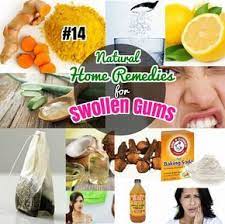 14 Best Home Remedies For Gingivitis Swollen Gums Easy Natural Home Remedies To Treat Sore Gums At Home Swollen Gum Gum Health Natural Home Remedies