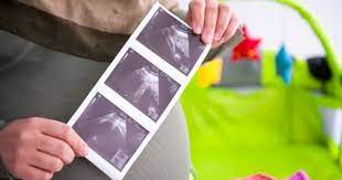 Doa Saat Usia Kehamilan 4 Bulan Popmama Com