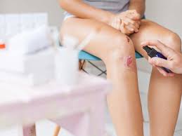 Melbourne, fl (view all cities). Signs Your Wound Is Infected Atlantis Urgent Care