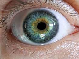 It occurs in humans and certain breeds of. My Central Heterochromia Everyone Calls My Eye Color Hazel Eyes