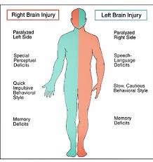 R Vs L Nurse Medical Knowledge Nursing Study