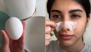 Todo mundo tem cravinhos no nariz mesmo? Clara De Ovo E Papel Toalha Para Remover Cravos E Deixar Nariz Lisinho Aprenda O Truque Vix