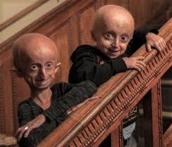 Progeria is usually detected in infancy or early childhood, often at regular checkups, when a baby first shows the characteristic signs of premature aging. Hutchinson Gilford Progeria Syndrome Medlineplus Genetics
