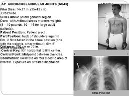 Learn vocabulary, terms and more with flashcards, games and other study tools. 4 Th Presentation Radiographic Technique Of Ribs Clavicle
