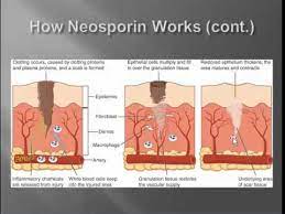 The antibiotic in bacitracin stops bacterial growth, while the antibiotics in neosporin stop bacterial growth and also kill existing bacteria. Group 23 Chemistry Of Neosporin Youtube