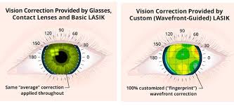 The Ultimate Guide To Lasik Eye Surgery Detailed Info On This Life Changing Surgical Procedure Lasik Lasik Eye Surgery Eye Surgery
