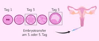 Nbsp;· september 2013 robonekos regenbogenbaby. Embryotransfer Auswahl Des Besten Zeitpunktes Fur Eine Ivf