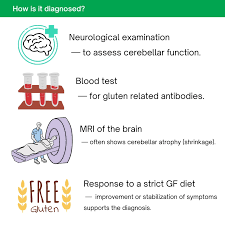 Image result for Cerebellar Function Test