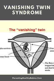 Pin On Pregnancy Hacks