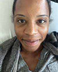 The doctor removed 12 fibroids. TWELVE! Y'all… the 2 they saw