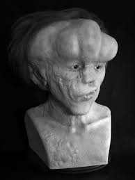 A member of the stands4 network. 1 1 John Merrick The Elephant Man Bust Rpf Costume And Prop Maker Community
