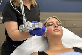 Image result for Laser Skin Procedure