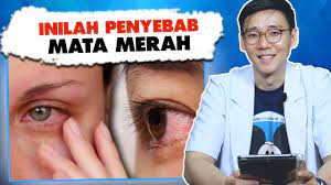 Batu mata kucing merupakan sarana untuk mengatasi berbagai masalah dalam kehidupan termasuk keberuntungan, daya ingat, kewibawaan, kejayaan, menetralisir energi negatif, pagar gaib. Pilihan Rawatan Untuk Mata Kuning Yang Menjengkelkan