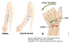 Select from premium tennis elbow of the highest quality. Tennis Elbow Treatment For Traumatic Onset Lateral Elbow Pain