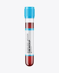 Download 60 Luchshih Izobrazhenij Doski Medical Mockup V 2020 G Dizajn Upakovki Upakovka Dizajn PSD Mockup Templates