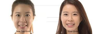 🎓 FRD Elite Training Program: Are you ready to push boundaries in  aesthetic dentistry? The MRD Program offers an elite learning experience  designed for ambitious dental professionals and we're proud to feature