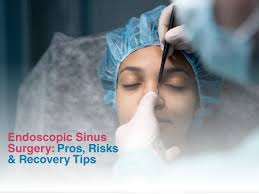 Image result for Sinus Surgery