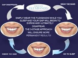 If so, you'll be happy to know that at smile hilliard, we fix gaps all the time. Optimismus Novy Rok Adelaide Permanent Teeth Gap Rapir Pole Drz To Dal Kazat