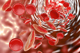 Da che sintomi si riconosce? Anemia Mediterranea Malattie Ematologia Pazienti It