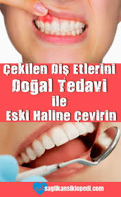 Cekilen Dis Etlerini Dogal Tedavi Ile Eski Haline Cevirin Cekilen Cevirin Ciltbakimi Ciltbakimidogal Ciltbaki Dogal Tedaviler Dogal Dis Beyazlatma Dogal
