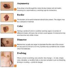 Lung Cancer Life Expectancy Lung Cancer Life Expectancy Healt Information Pinterest Lung Cancer And Lungs