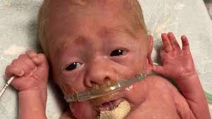 Fundraiser by Kiley Cobb : Supporting Logan's Medical Journey