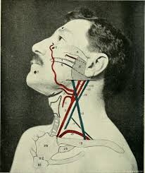 There are two large arteries in the neck, one on each side. Common Carotid Artery Physiopedia