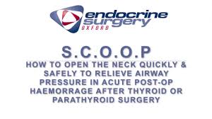 SCOOP: Acute Management of Post Op Haemorrhage in Thyroid and Parathyroid  Surgery - YouTube