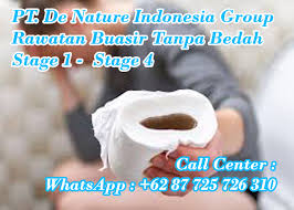 Cara merawat buasir, petua buasir, buasir ketika hamil, ubat buasir luar , punca berak berdarah, najis berdarah. Storymapjs Inilah Ubat Kecutkan Buasir Selepas Bersalin Berkesan
