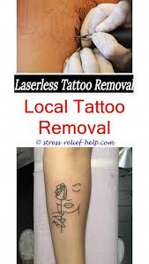 Can U Get A Tattoo Removed While Pregnant How To Remove Temporary Tattoos Where To Buy Tattoo Removal Cre Tattoo Removal Cost Laser Tattoo Tattoo Removal Cream