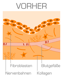 Prostatitis Therapie Prostataentzundung Behandeln Prosturol