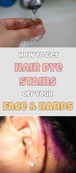 How To Get Hair Dye Stains Off Your Face And Hands Beauty Total Com Hair Dye Removal Hair Color Remover How To Get Red Hair
