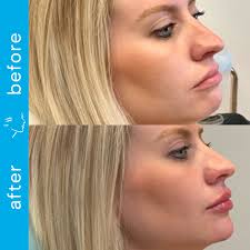 Meet Katie Winner, RN