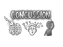 Image result for Concussion