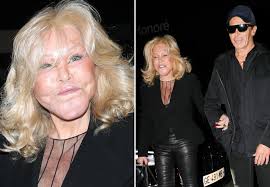 Jocelyn Wildenstein: The Catwoman’s Glamorous Life