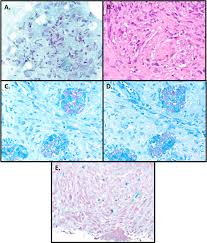 Image result for Rhodococcus equi