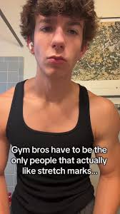 Does David Laid Have Stretch Marks