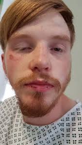 Mum fears 'the next person will be be killed' after son attacked and robbed 